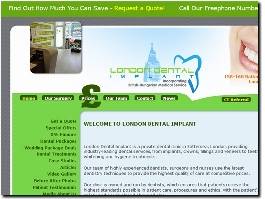 https://www.london-dental-implant.co.uk/ website