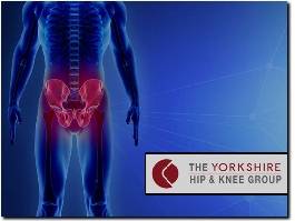 https://www.yorkshirehipandknee.com/ website